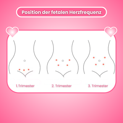 BabySounds - #1 Bewährter Fetal Doppler für zu Hause