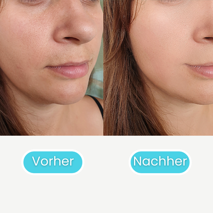 Skin Booster Pro - #1 K-Beauty Hautpflege Gerät