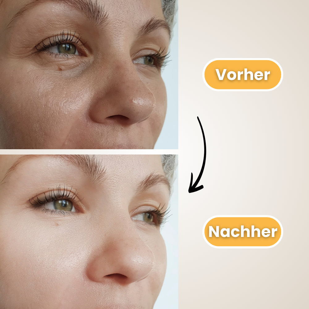 Glassari Skin Booster - #1 Anti-Falten Hautpflegegerät