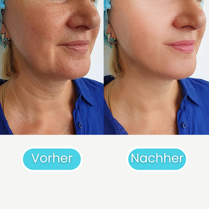 Skin Booster Pro - #1 K-Beauty Hautpflege Gerät