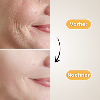 Glassari Skin Booster - #1 Anti-Falten Hautpflegegerät